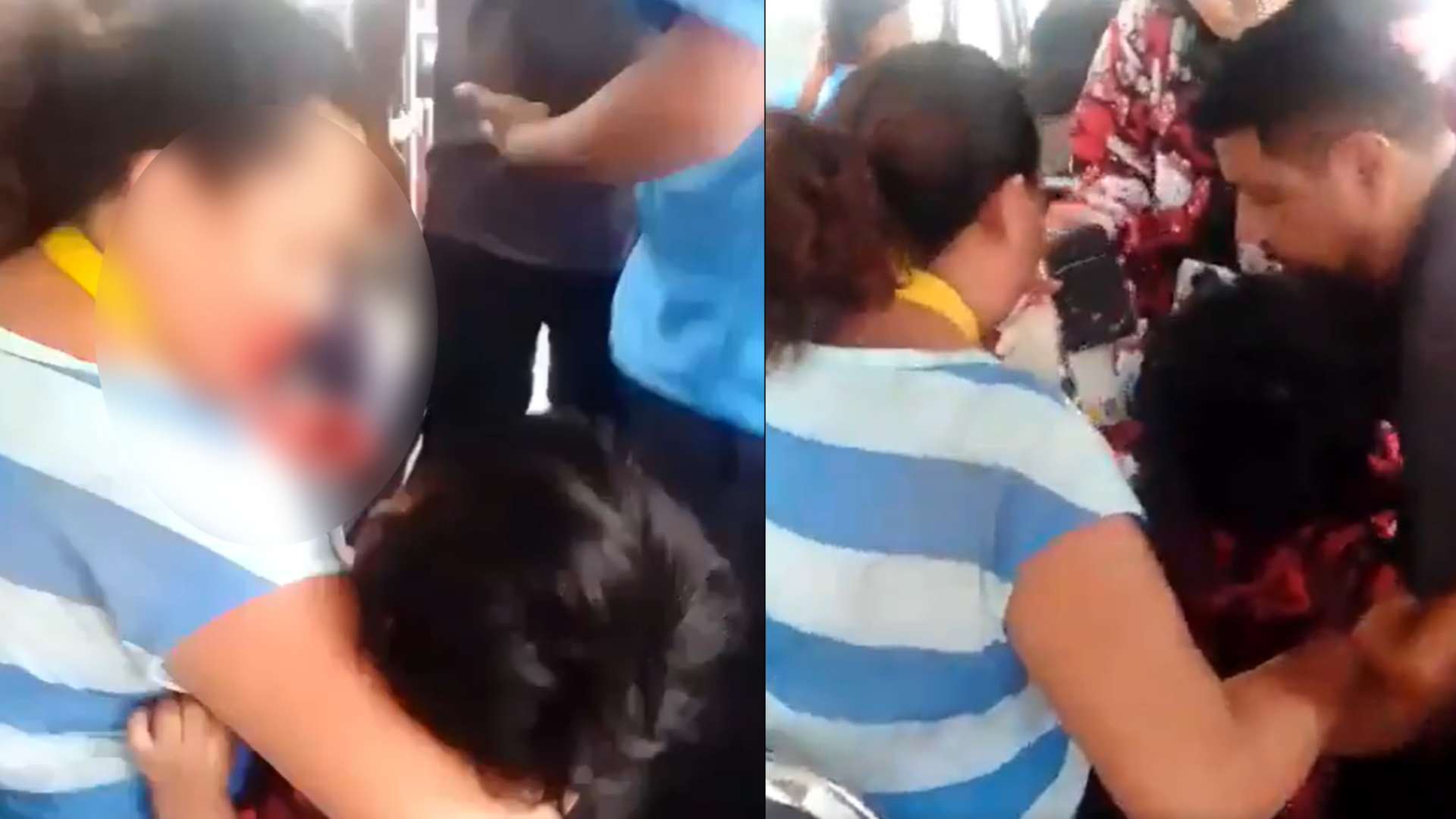Se queda sin dientes en accidente